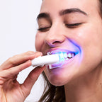 Teeth Whitening Kit Refill Gels - 6 Treatments