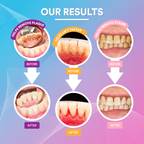 Ultrasonic Tooth Cleaner *BEST SELLER* DP3