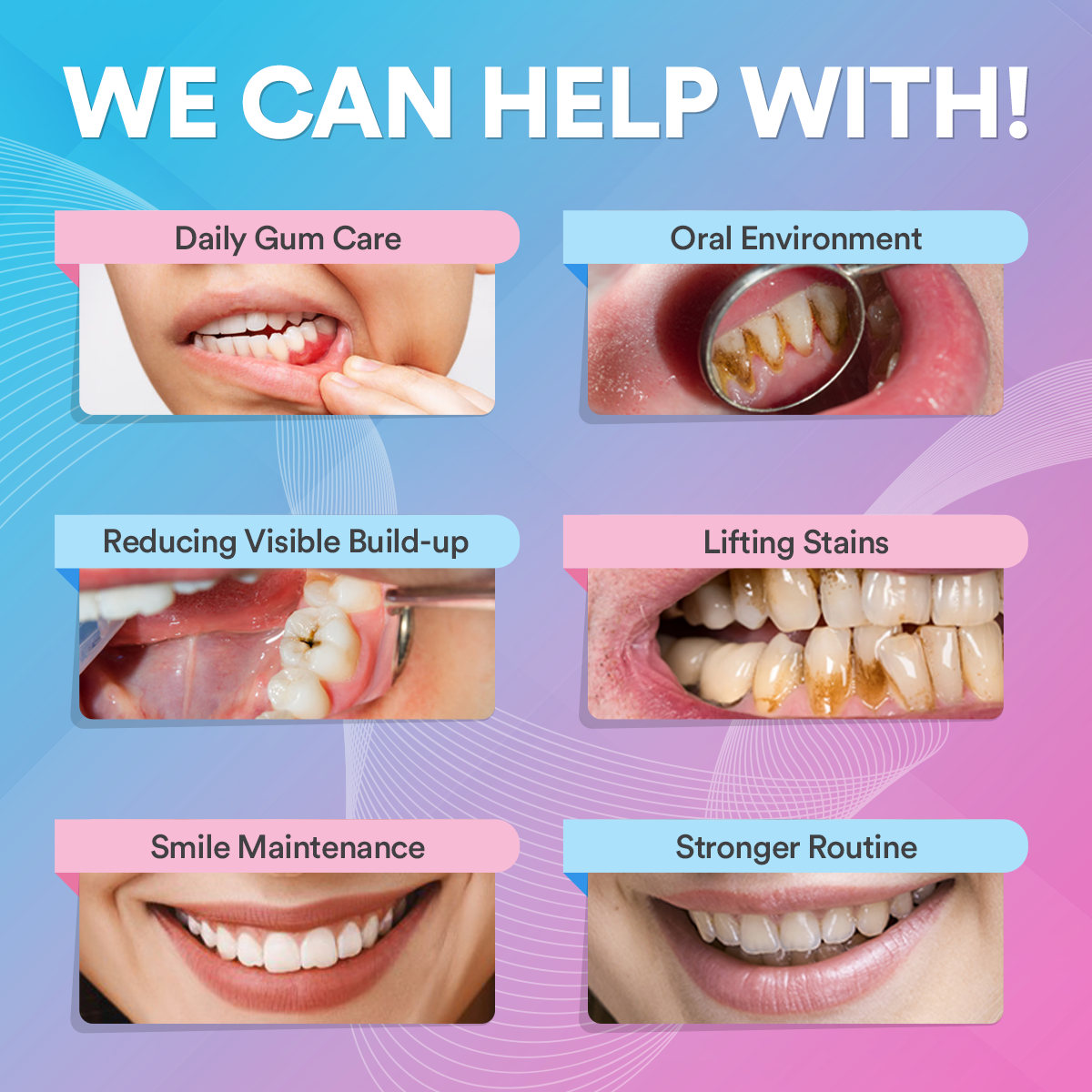 Ultrasonic Tooth Cleaner *BEST SELLER* DP3