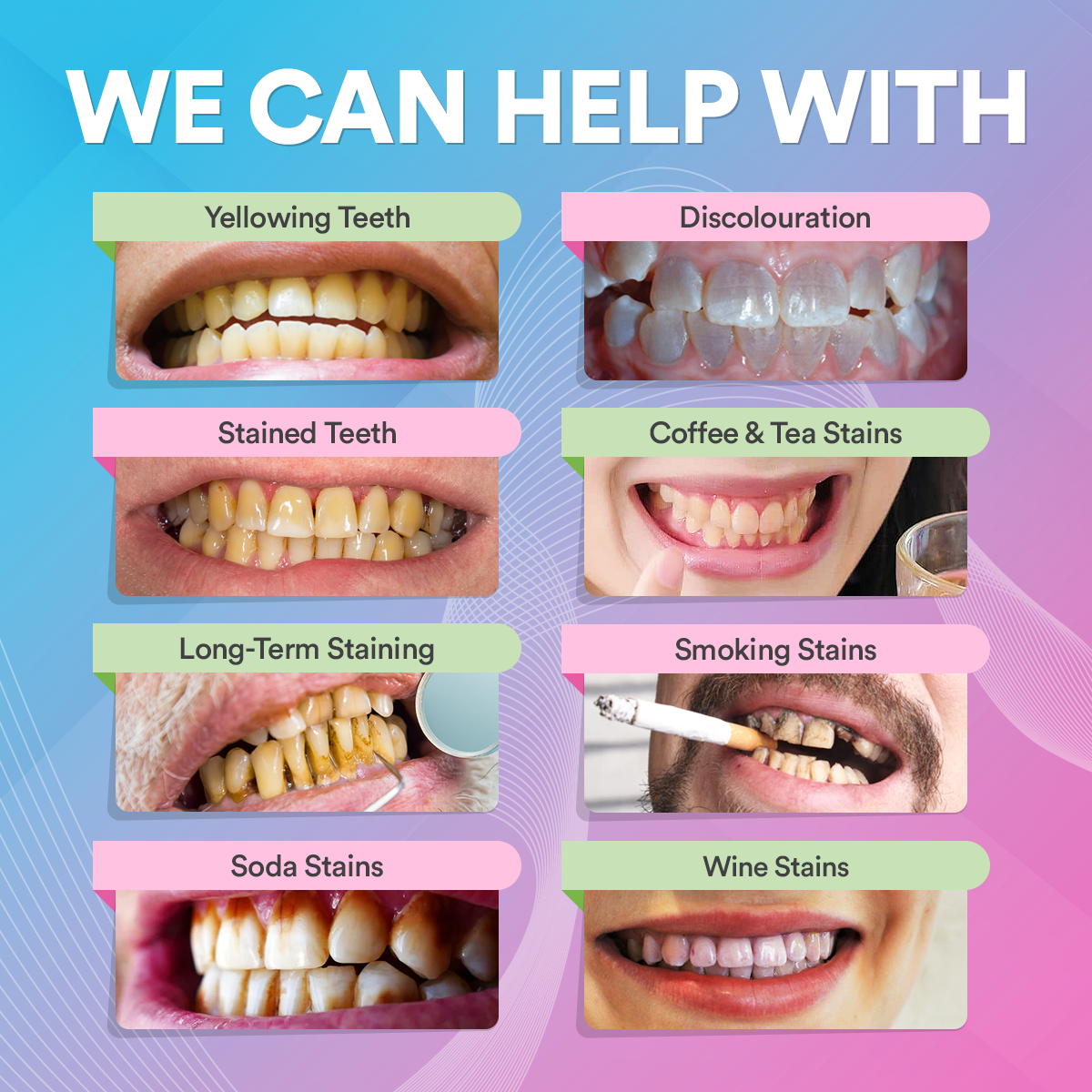 Teeth Whitening Pen