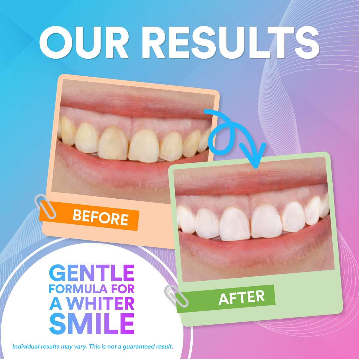 Toothpaste Tablets - (30 Per Pack)
