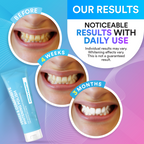 Veneer & Composite Whitening Polish Toothpaste